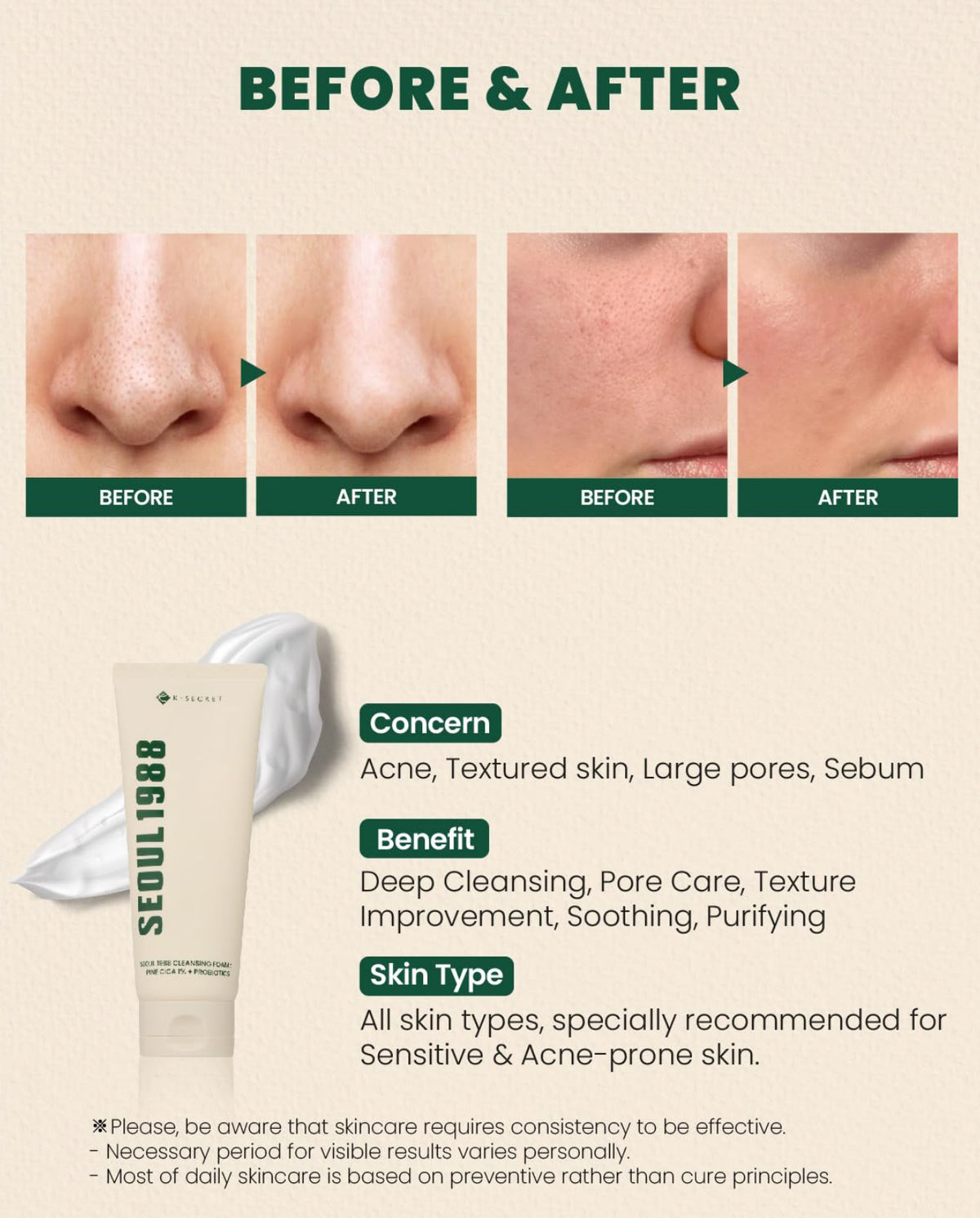 K-SECRET Seoul 1988 Cleansing Foam Fine Cica 1% + Probiotics (150ml)